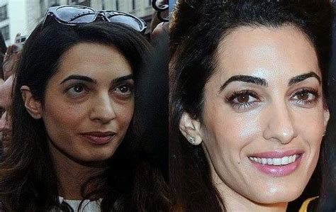 amal clooney breast implants|Amal Clooney's Before & After Transformation .